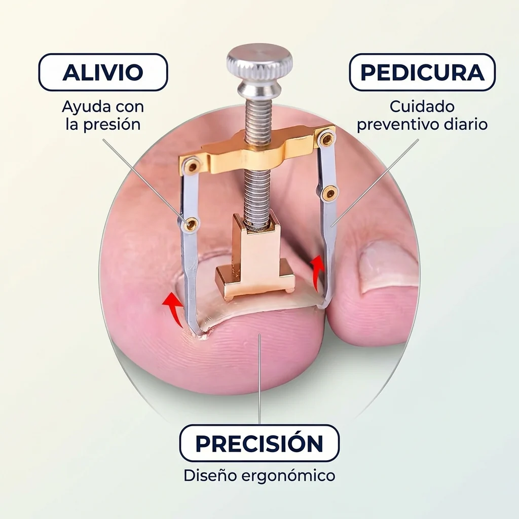 Corrector de Uñas Encarnadas Acero – Cuidado Suave en Casa - Image 3