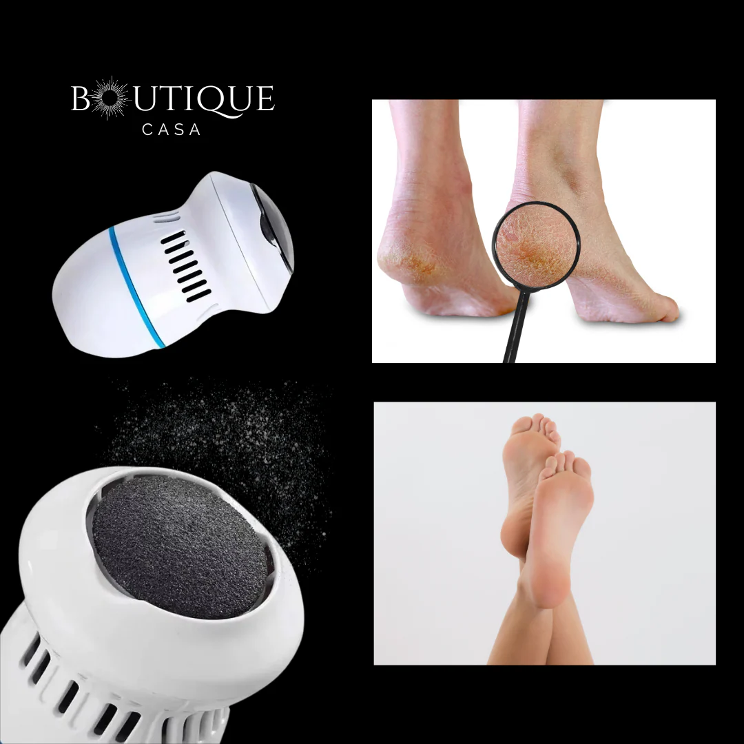 Dermapies Pro - Eliminador de Callos – Tratamiento de durezas y mejora de tu bienestar - Image 3