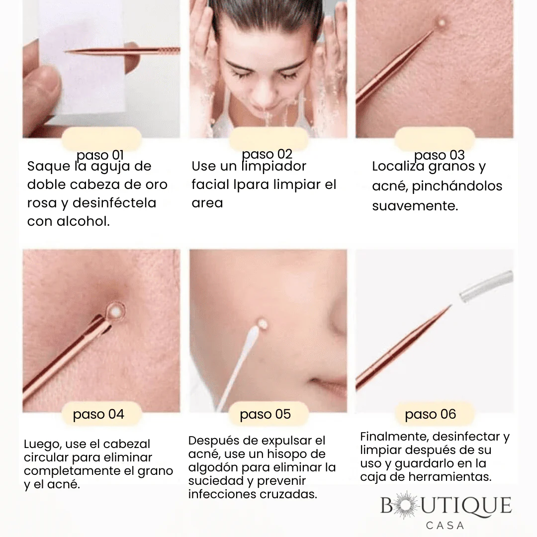 Kit Extractor Profesional de Acné | ClearSkin™ - Image 3