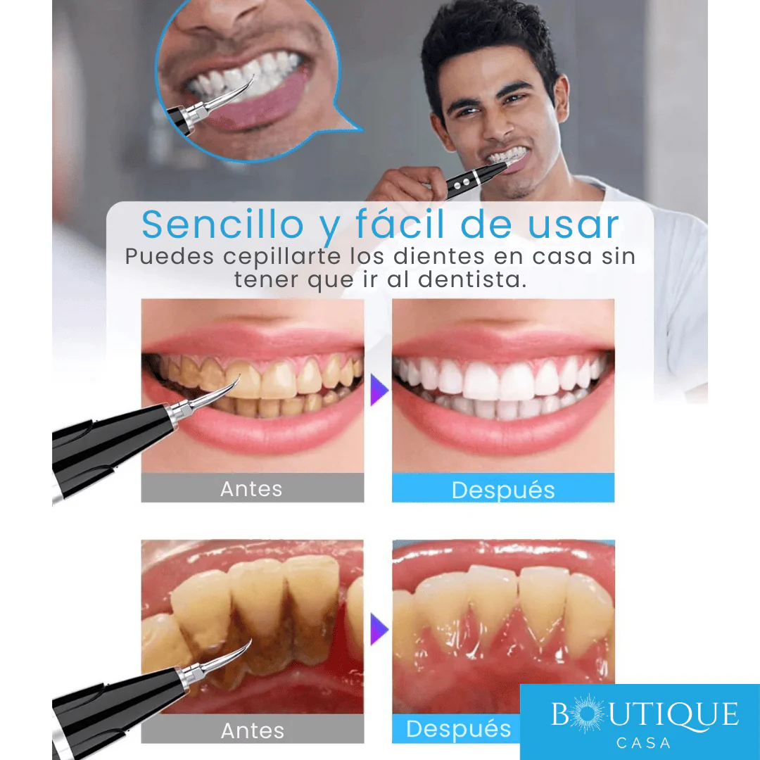 Limpiador Dental Ultrasónico | UltraClean™ - Image 3